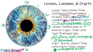 Iridology Lesson  Signs in the Iris Lesions Lacunae amp Crypts pt 1 [upl. by Alisun]