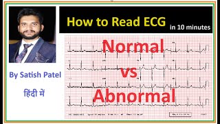 How to read an ECG normal vs abnormal ECGpna1 satishpatel [upl. by Bret]