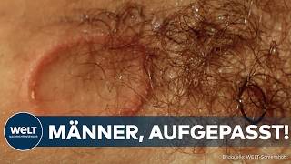 PILZ IN BARBERSHOPS Männer aufgepasst Immer mehr Kunden haben nach ihrem Friseurbesuch Hautpilz [upl. by Rothwell]