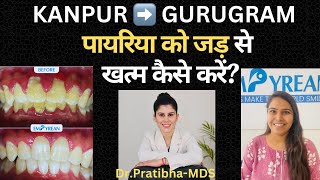 पायरिया को जड़ से खत्म कैसे करें Permanent Treatment for Bleeding Gums  Pyorrhoea  Gum Disease [upl. by Ilecara]