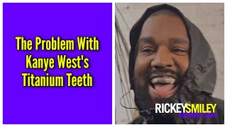 The Problem With Kanye Wests Titanium Teeth [upl. by Neelrahc]