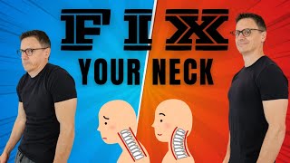 Decompress Your NECK  Self Traction Your Neck For Pain Relief  Dr Jon Saunders [upl. by Arnelle24]