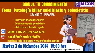 494 Dibujando tu conocimiento Colecistitis [upl. by Deenya]