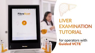 Tutorial liver examination with FibroScan® and Guided VCTE™ [upl. by Annotahs278]