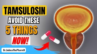 Taking Tamsulosin 5 Things You Must Avoid If You Are Taking Tamsulosin [upl. by Ltihcox]