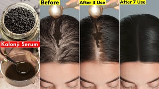 दुगनी तेज़ी से बढ़ेंगे बाल👆🏼Get Double Hair GrowthApply on Thinning HairStop Hair LossBalding Scalp [upl. by Erdua202]