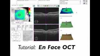 Tutorial En Face OCT Imaging [upl. by Alvita]