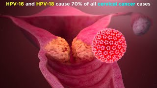 Human Papillomavirus HPV [upl. by Zebulen]