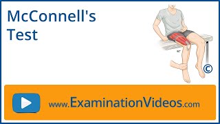 McConnells Test [upl. by Reddin]