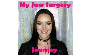 My Double Jaw Surgery Journey Gummy smile and overbite Before and After photos [upl. by Sitoiyanap]