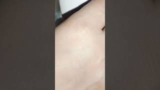 Ipl laser hair removal at home hairremoval ipllaser newtrend shortsvideo dailydairy95 [upl. by Ganley390]