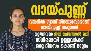 വായ്പുണ്ണ് പൂർണമായും മാറ്റാൻ തൈര് കൊണ്ട് ഇങ്ങനെ ചെയ്യൂ  vaypunn maran [upl. by Milinda466]