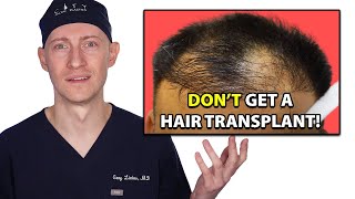 10 Reasons  Do Not Get A Hair Transplant  Hair Surgeon Reacts [upl. by Adnoyek]