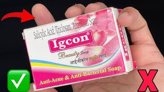 Igcon Cream Side Effects kaise thik kare  Fairness in 3 night [upl. by Faustine]