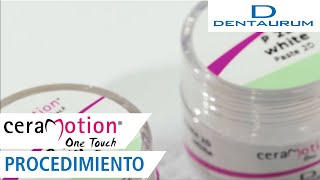 Procedimiento para ceraMotion® One Touch [upl. by Okihcas]