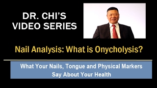 Dr Chis Fingernail and Tongue Analysis  Onycholysis [upl. by Wootten270]