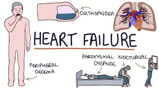 Understanding Heart Failure Visual Explanation for Students [upl. by Aerdna]