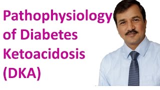 Diabetes Ketoacidosis DKA  Pathophysiology [upl. by Friday]