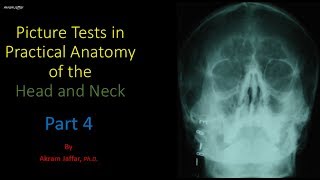 Picture tests in head and neck anatomy 4 [upl. by Lorinda]