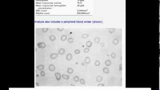 USMLE step 3 neurology MCQ and answer [upl. by Mclaughlin]