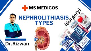 NephrolithiasisSurgeryMS MedicosDr RizwanUrdu Hindi Easy Explanations [upl. by Nylde]