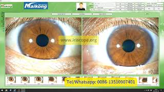 Maikong iridology software Operation Video Teaching 2024 Version [upl. by Eneli]