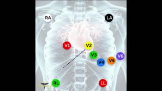 ECG PLACEMENT  12 LEAD ECG [upl. by Aronek]