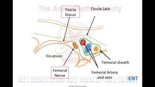 US GUIDED 2 in 1 Block FOR HIP FRACTURES [upl. by Adlaremse]