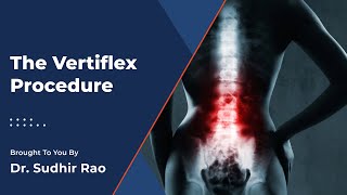 Vertiflex Treatment  Pain and Spine Specialists [upl. by Jovitta731]