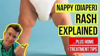 What are SYMPTOMS OF NAPPY DIAPER RASH and HOW DO I TREAT it at home  Doctor ODonovan explains [upl. by Schinica]