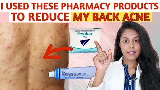 How did I cleared my BACK ACNE using only PHARMACY PRODUCTS தமிழில் [upl. by Aninad]