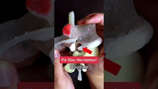 Disc Herniation Routine for PainRelief [upl. by Camellia441]