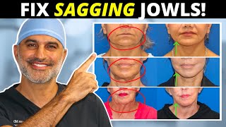 Sagging Jowls 101 How they form and what to do about them tighten and eliminate [upl. by Aehsrop]