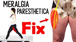 Meralgia paresthetica  upper leg pain  upper thigh pain [upl. by Akirdnahs]