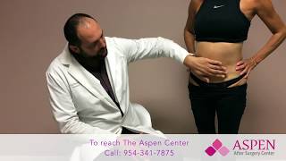 Liposuction Contour Irregularity  Stubborn Lipo Lumps and Bumps [upl. by Ed137]