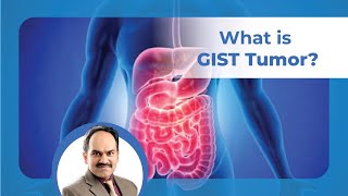 What is GIST  What is Gastrointestinal Stromal Tumor  Dr Anil Kamath  Healius [upl. by Nakre]