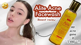 Best affordable salicylic acid facewash  Alite facewash 💦 [upl. by Irak]