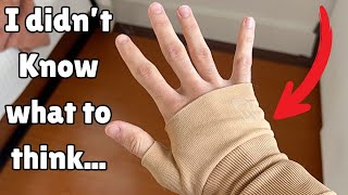 Arthritis Support Brace Honest Thoughts  Review [upl. by Anaic124]