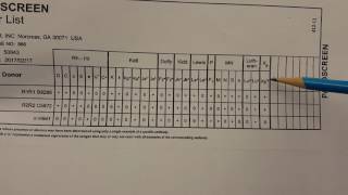 Blood Banking Antibody Screen Setup Part 2 [upl. by Tollmann]