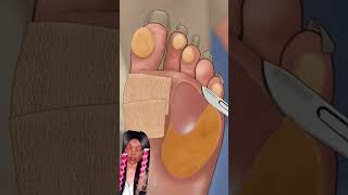 Foot dead skin peel treatment asmr asmrsounds foot skincare skincareanimation facialhair [upl. by Hollingsworth]