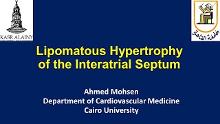 Lipomatous hypertrophy of the Interatrial Septum Lipomatous atrial septal hypertrophy LASH [upl. by Herby]