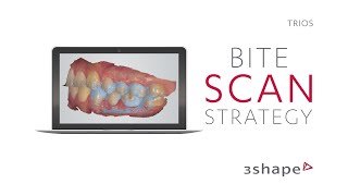 3Shape TRIOS Scan Strategy Bite [upl. by Adnilra]