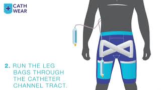 Nephrostomy Drainage Catheter [upl. by Teiv153]