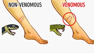 Venomous Snake vs Non Venomous Snake  How to Identify [upl. by Stempien398]