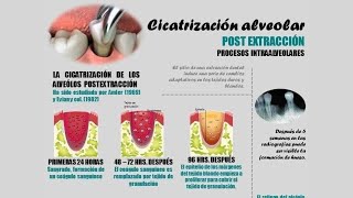 Cicatrización alveolar post extracción dental 🦷 [upl. by Naivad540]