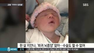 교황 기적의 입맞춤…1살배기 뇌종양 사라져  SBS [upl. by Atilemrac]