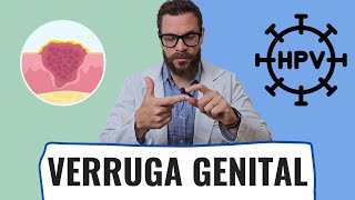 Verruga Genital e Tratamento para HPV Soluções Eficazes para Homens [upl. by Asyar]