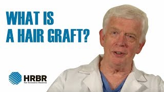 What is a hair graft  Hair Restoration Clinic Blackrock HRBR [upl. by Marlyn]