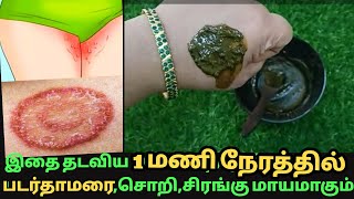 தடவிய 1மணி நேரத்தில் படர்தாமரைசொறிசிரங்குஅரிப்புதோல்நோய் மாயமாகும் ringwormallergy itching [upl. by Dodwell]