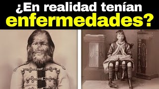 20 Fenómenos De Circo Que Existieron De Verdad [upl. by Naaitsirhc]